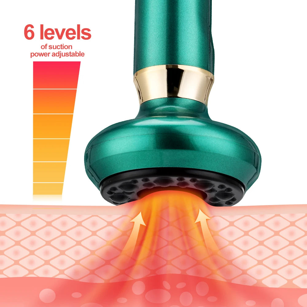 Electric Cupping Massager – Vacuum Suction, Guasha Scraping, Infrared Heat, Anti-Cellulite & Slimming Therapy