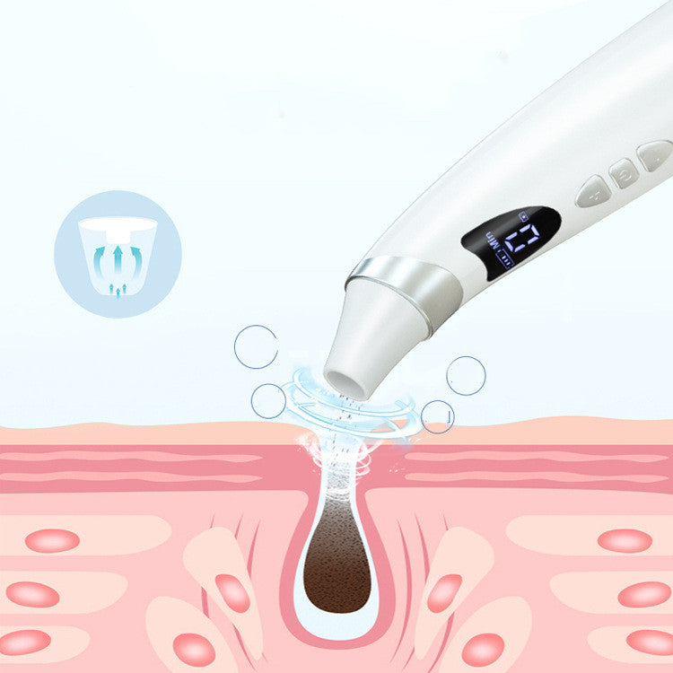 Electric Visual Blackhead Remover – Deep Pore Vacuum Cleaner with HD Camera & App Connectivity